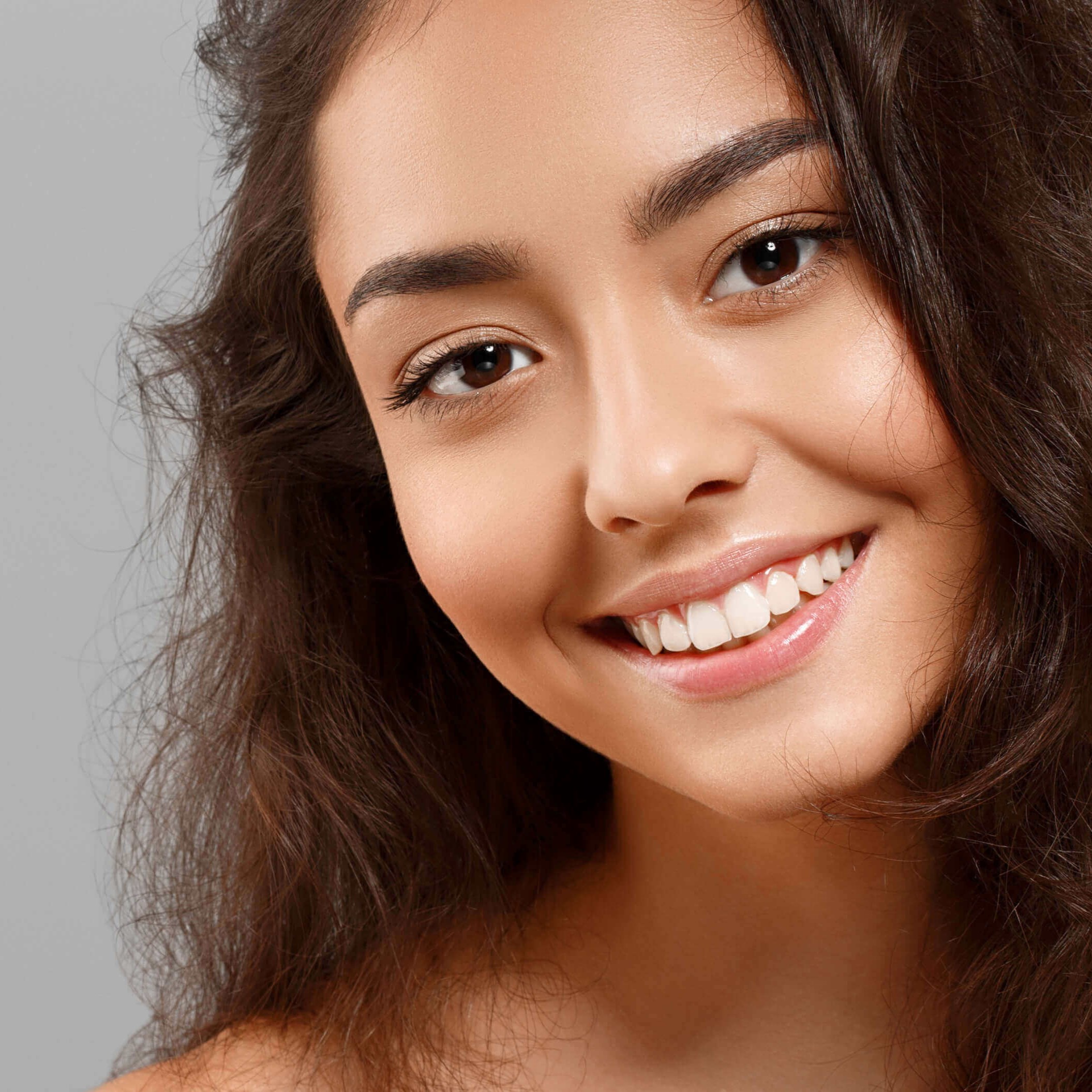 Smile Makeover
